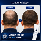 HairBorn™ Peel ion - Hair Regrowth Serum
