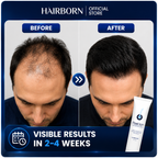 HairBorn™ Peel ion - Hair Regrowth Serum