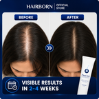 HairBorn™ Peel ion - Hair Regrowth Serum