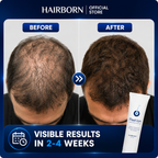 HairBorn™ Peel ion - Hair Regrowth Serum